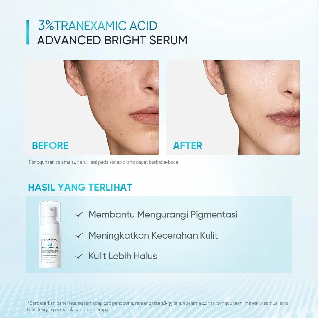 SKINTIFIC - 3% Tranexamic Acid Advanced Bright Serum