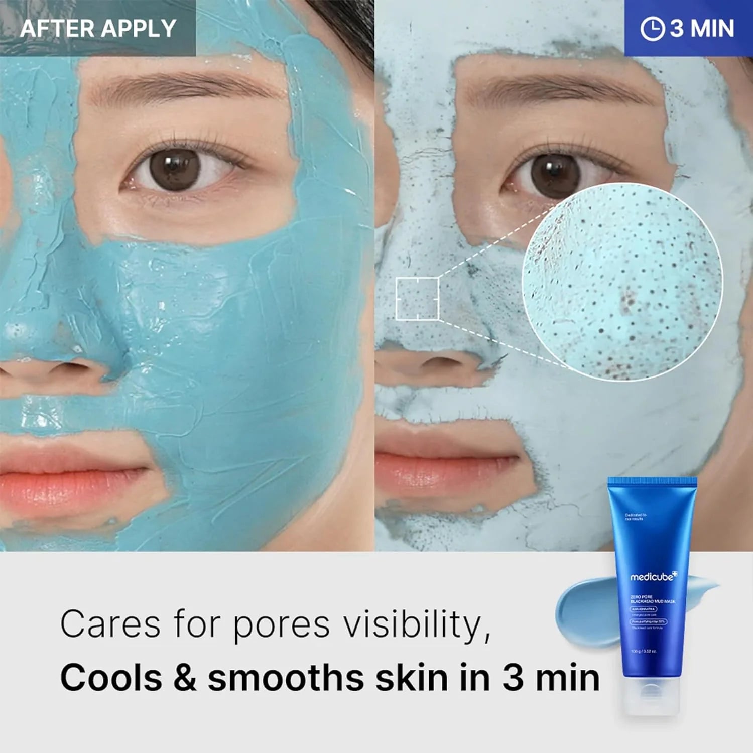 MEDICUBE - Zero Pore Blackhead Mud Mask