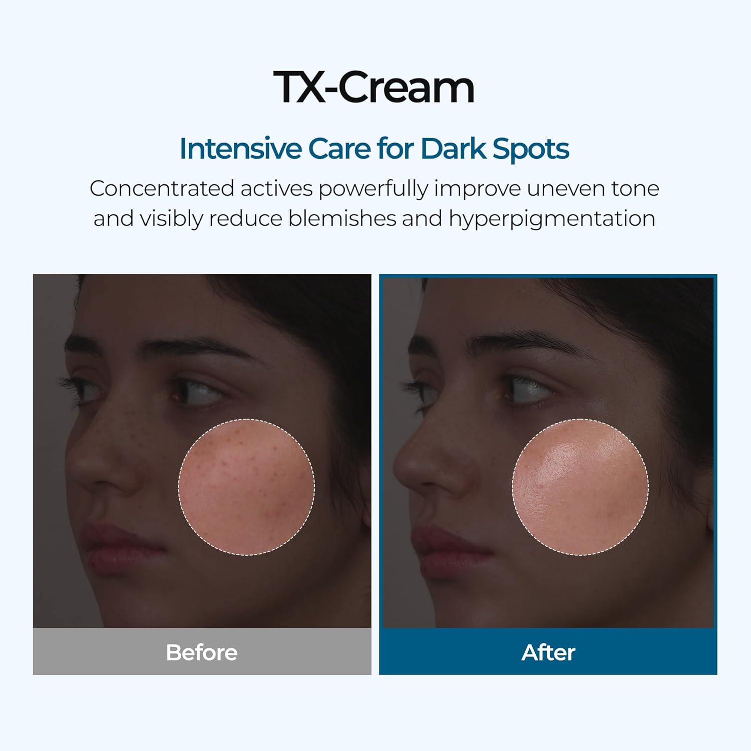 DR. MELAXIN - TX Cream