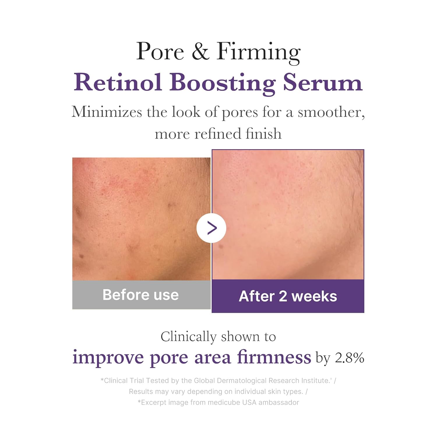 MEDICUBE - Retinol NMN Boosting Serum