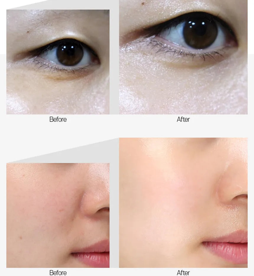 MEDI-PEEL - Mezzo Filla Eye Serum