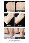 PLU - Perfect Foot Callus Razor